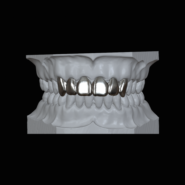 Deep Cut Grillz