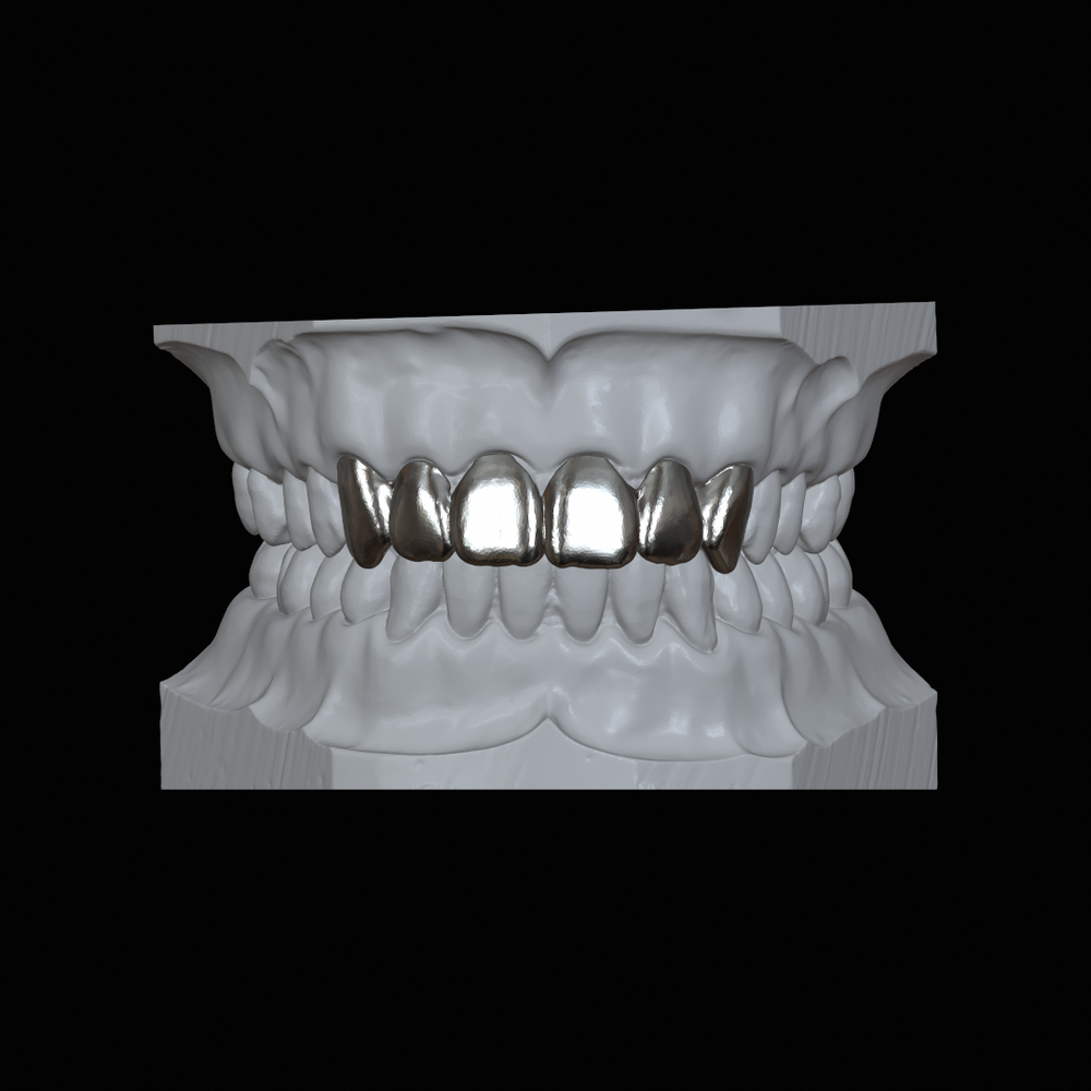 Deep Cut Grillz