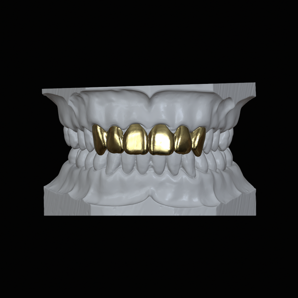 Gold Plated Deep Cut Grillz