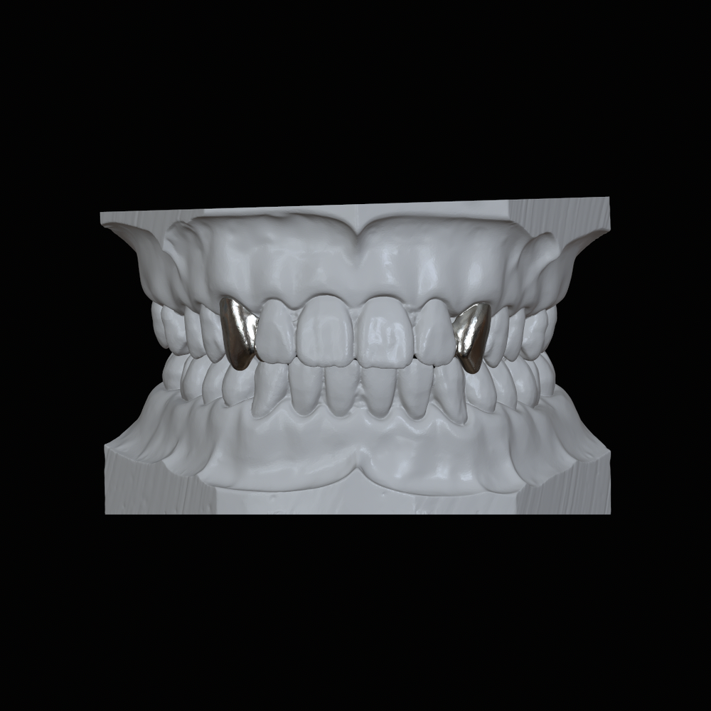Upper Fang Grillz