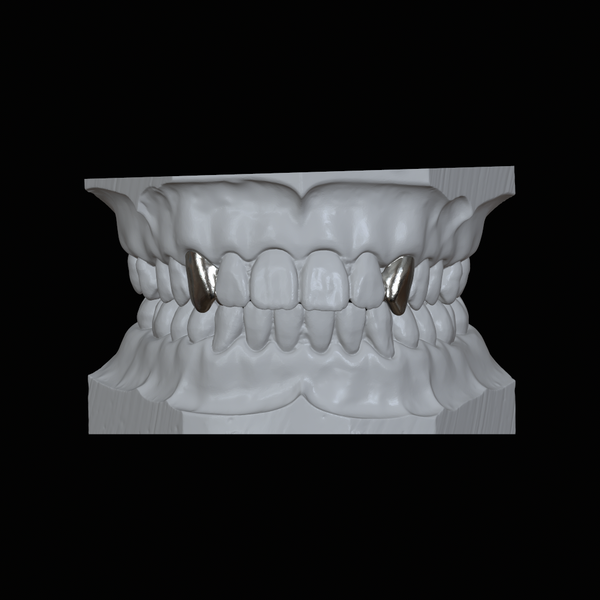 Upper Fang Grillz